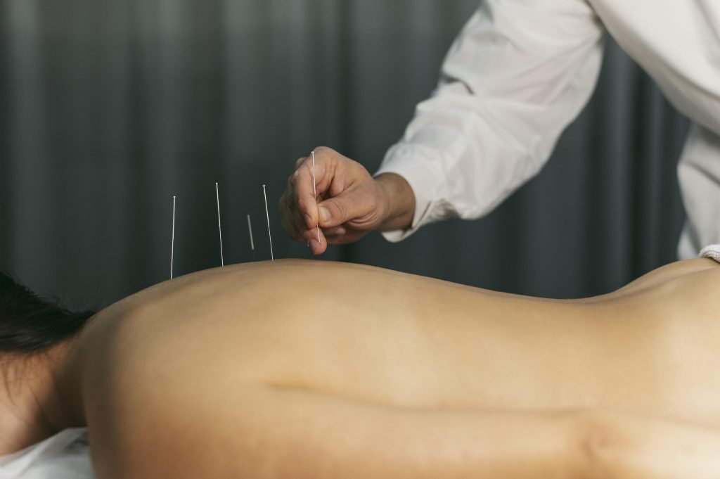 Acupuncturist in Spijkenisse